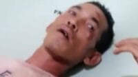 Diduga Oknum Brimob dan Sucurity Ngepam di PT Agro Muara Rupit Aniaya Warga Sipil